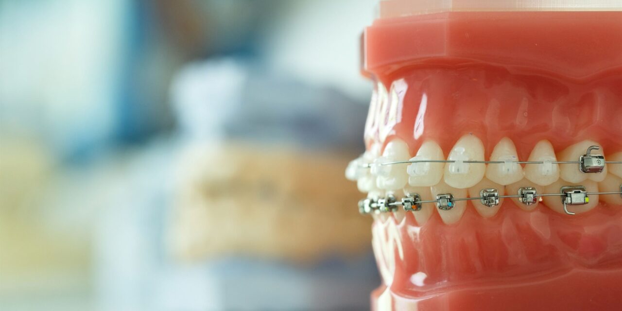 Leczenie ortodontyczne wad zgryzu