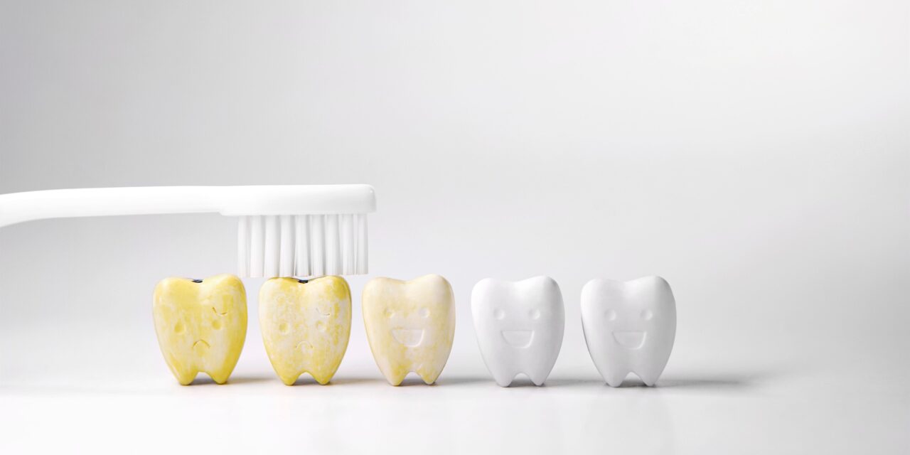 Przebarwienia na zębach – przyczyny, leczenie, zapobieganie